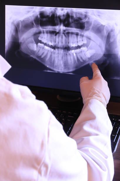 Best Emergency Dentist for Knocked-Out Tooth in Glandorf, OH