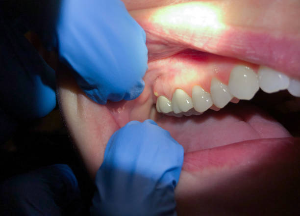 Best Mobile Emergency Dentist in Glandorf, OH